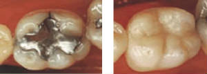 amalgamtocomp.jpg.w300h107.jpg